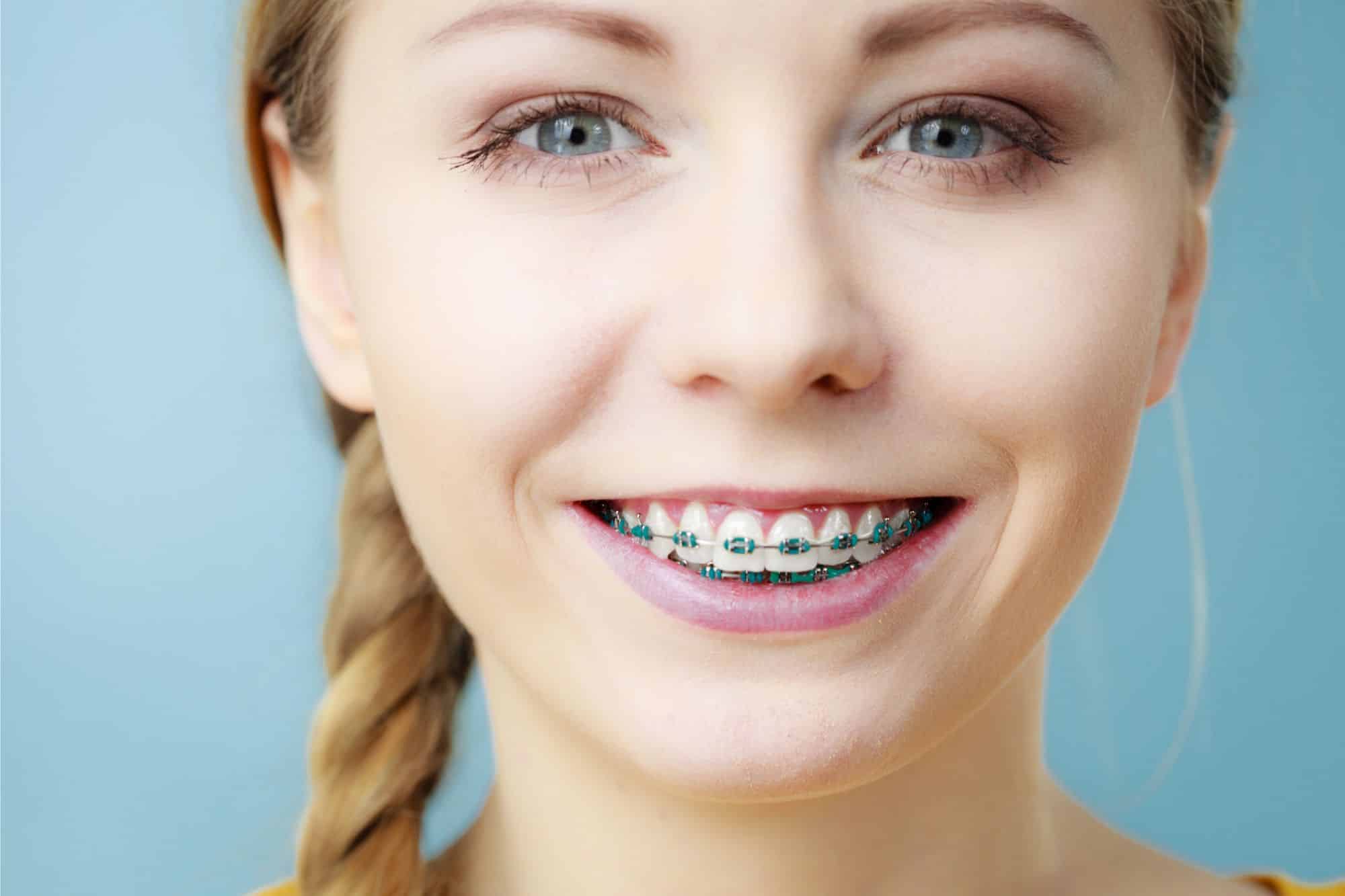 Hillsboro Braces