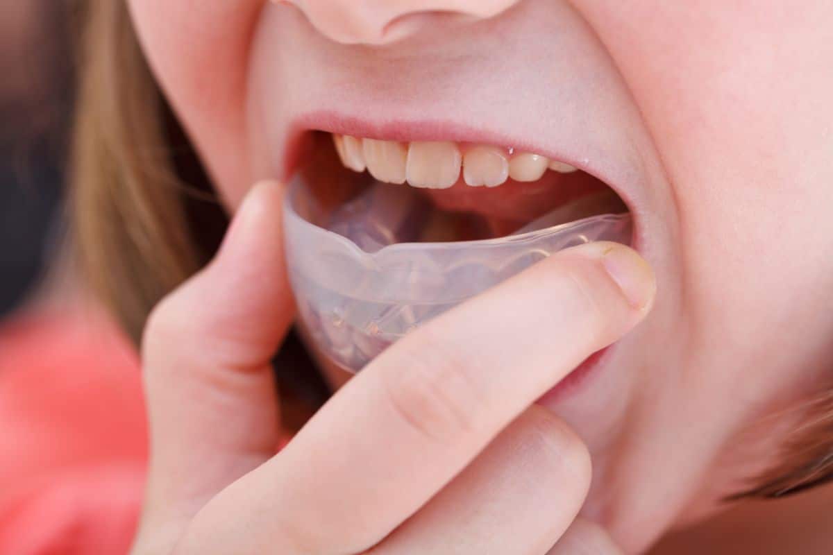 Orthodontic Emergencies and Sports Safety for Kids Mouths