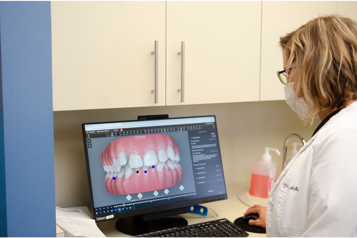 Your Guide To Palatal Expanders