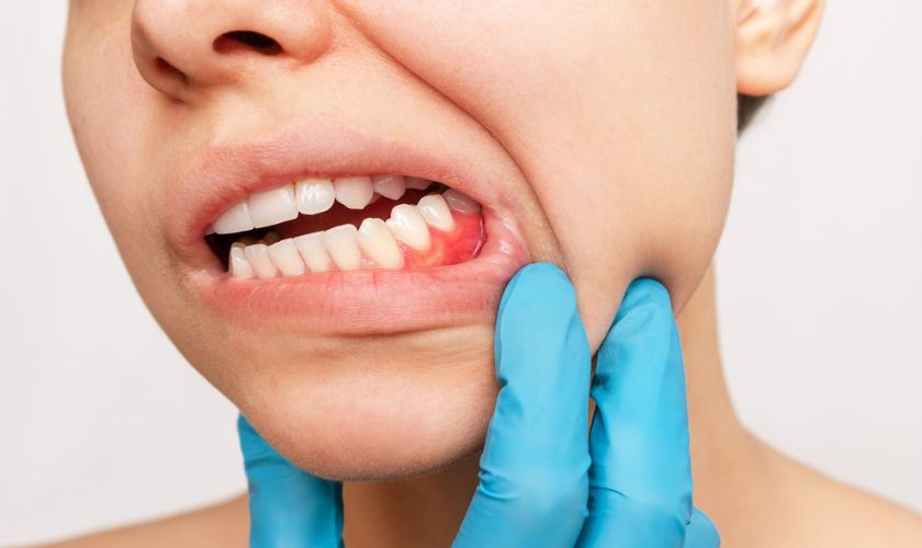 Orthodontic Treatment in Hillsboro