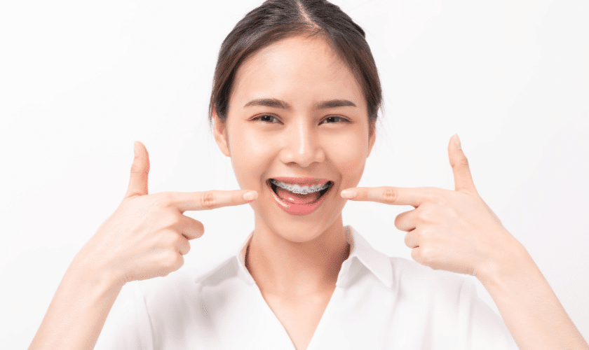 Clear Braces in Laidlaw Orthodontists