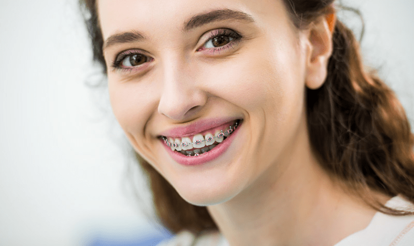Smiling young woman with braces displaying healthy teeth in dental office setting.