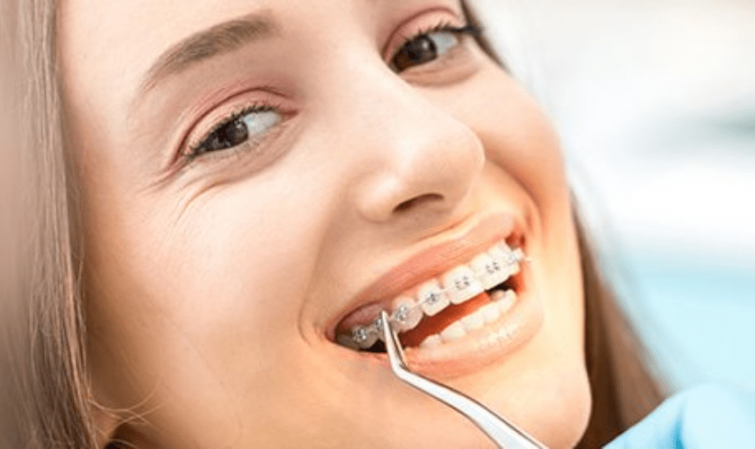 Braces in Hillsboro