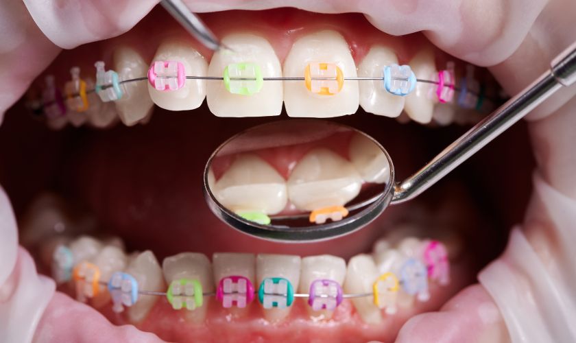 Orthodontists Hillsboro - laidlaw Orthodontics