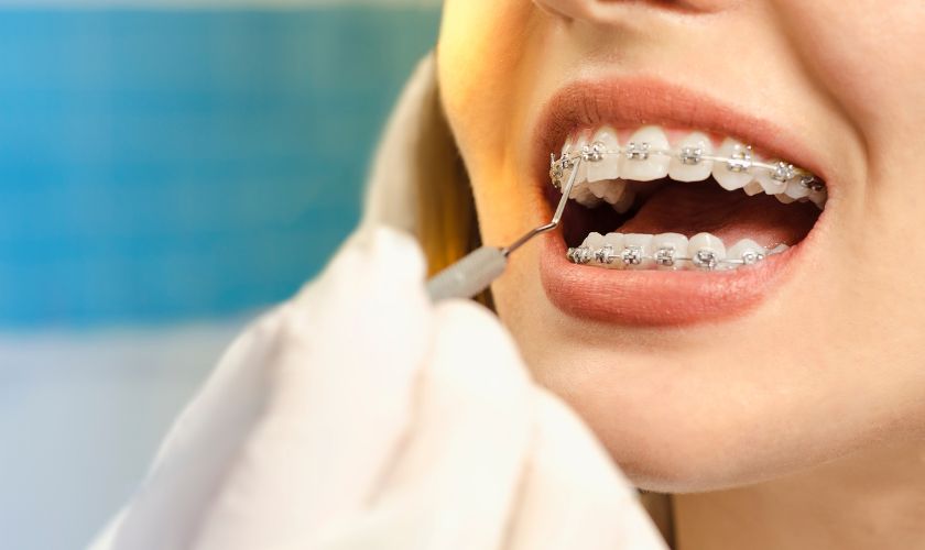 Orthodontist-In-Hillsboro