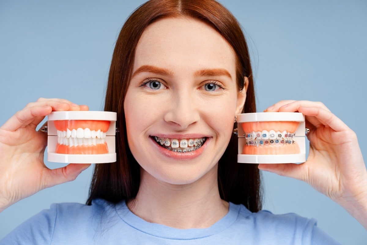 Braces-in-Hillsboro