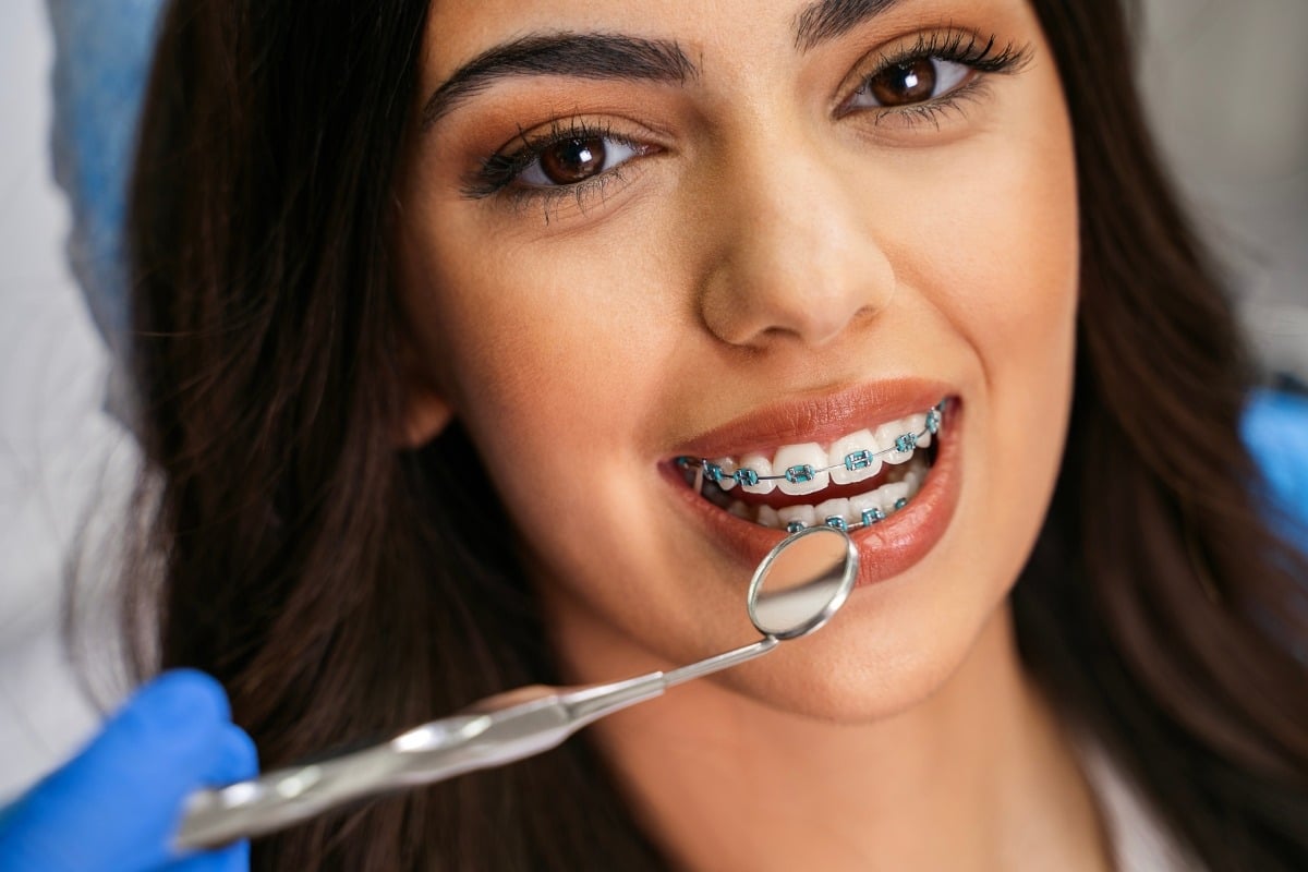 Braces