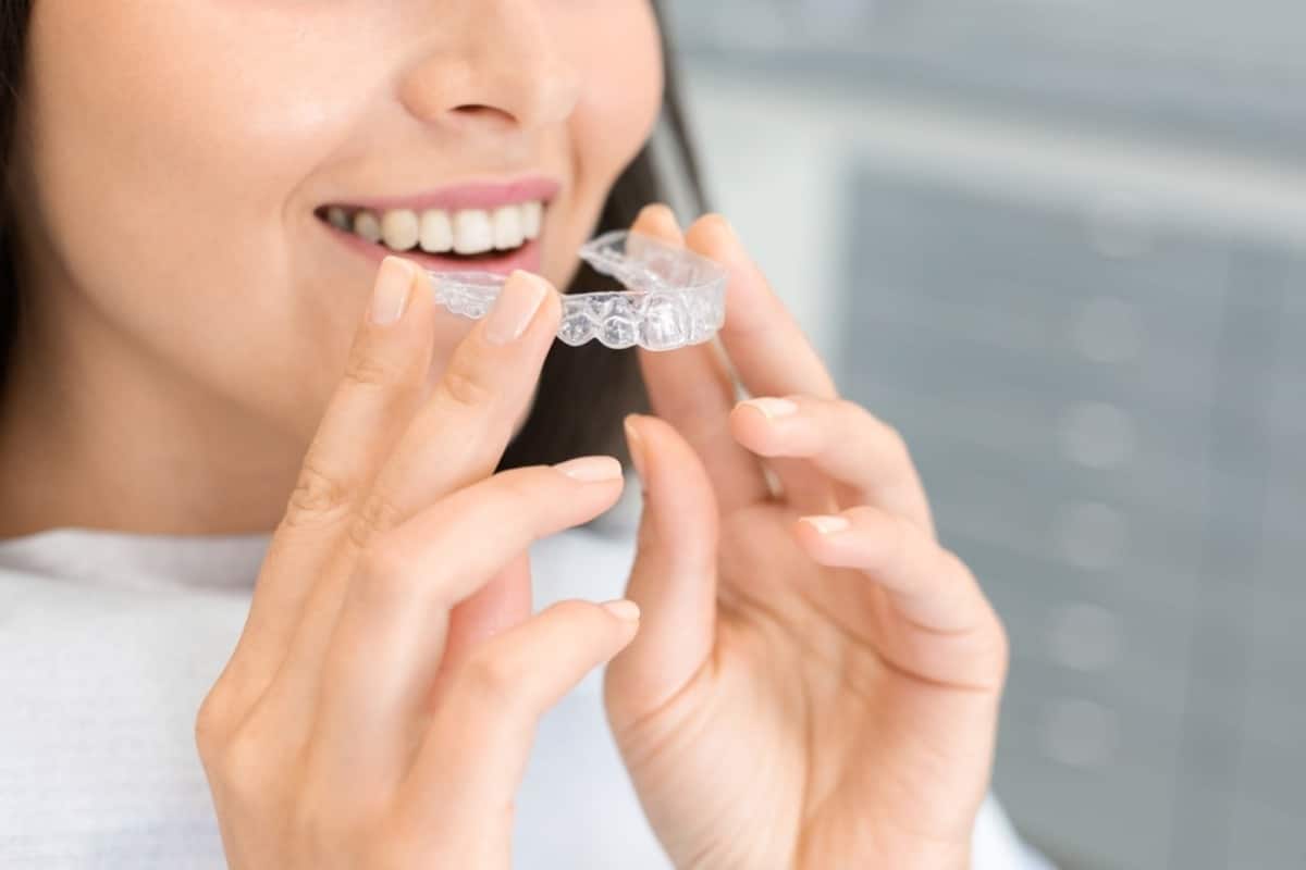 Straighten Your Teeth Without Braces