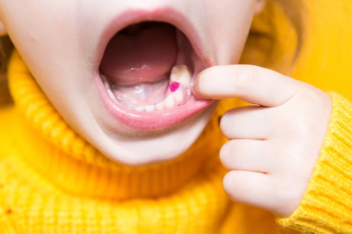 chewing Gum Increases the Risk of Cavities