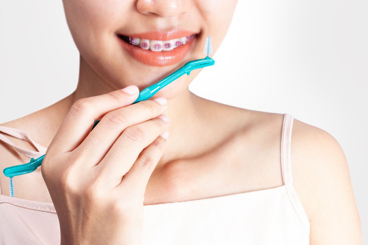 How to Remove Food Stuck in Braces Safely?