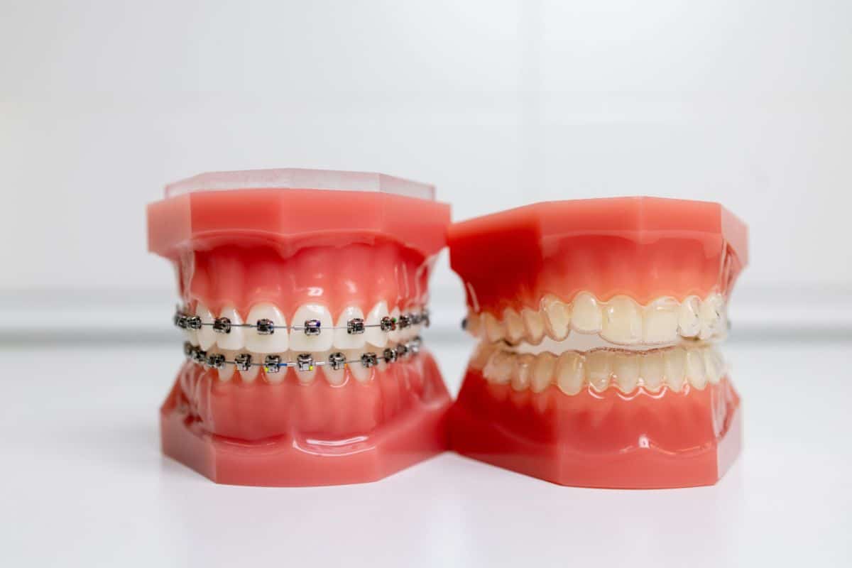 hillsboro orthodontic treatment