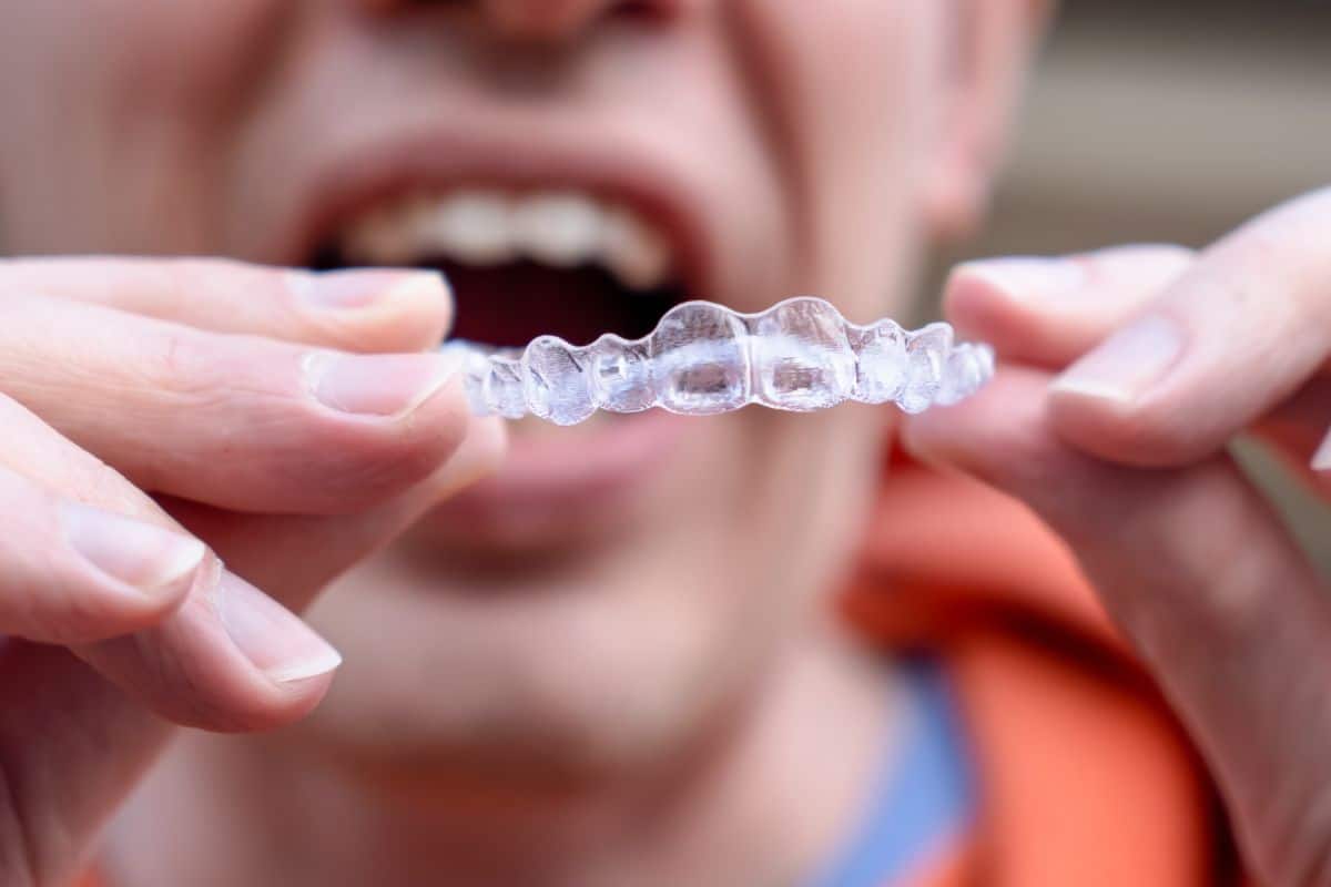 Invisalign for Complex Dental Issues