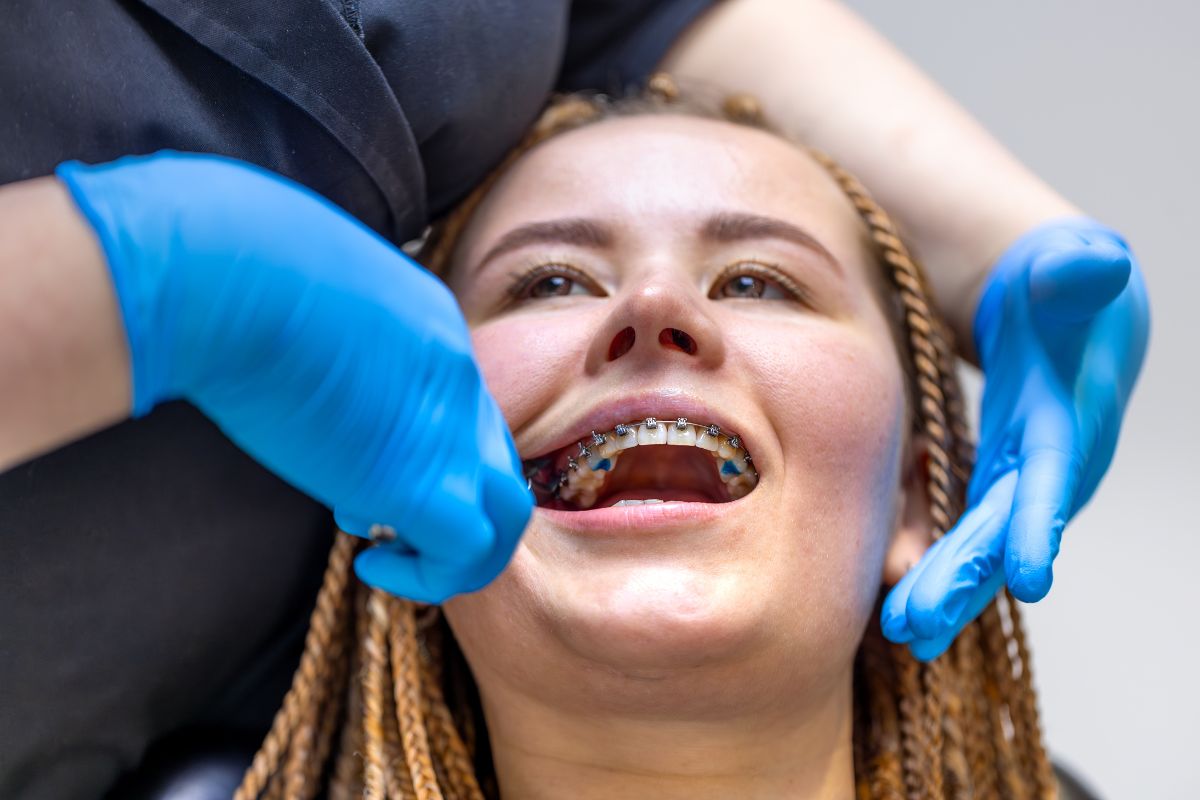 Orthodontist adjusting metal braces