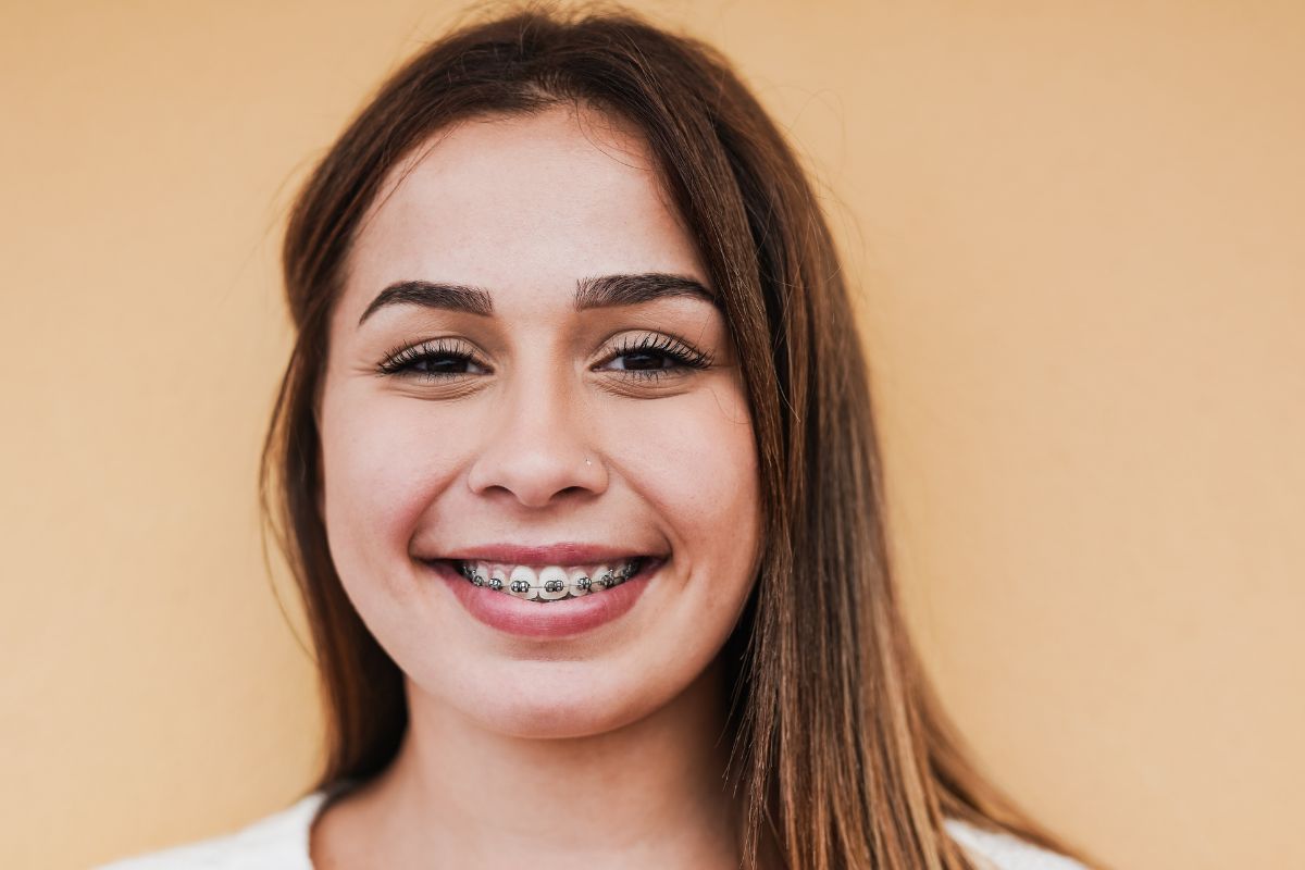 Braces on teeth with careful enamel protection