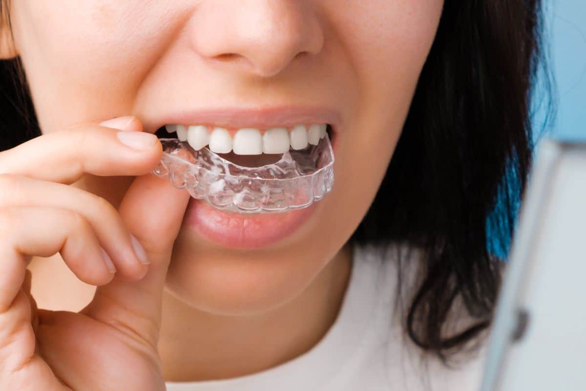 Patient experiencing dry mouth with Invisalign