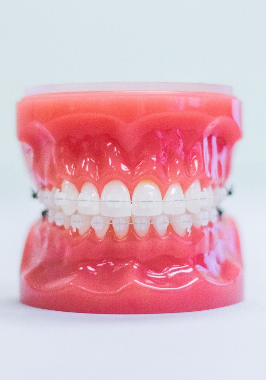 Clear Braces